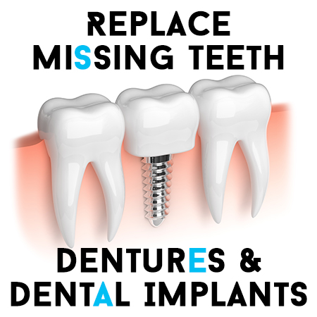 Replace Missing Front teeth with Tooth Colored filling, Implant or denture