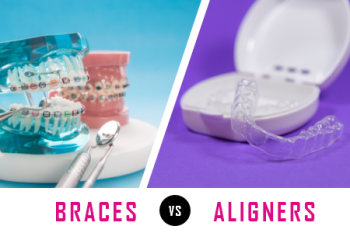 Fuquay-Varina dentist, Dr. McCormick at Fuquay Family Dentistry, talks about what factors need to be considered when deciding between getting braces or clear aligners for corrections.