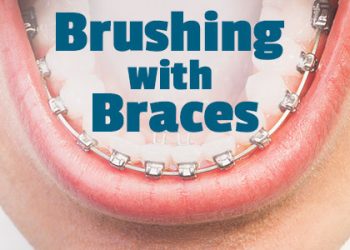 Fuquay-Varina dentists at Fuquay Family Dentistry inform patients about the best tools and tricks to use when performing oral hygiene routines with braces.