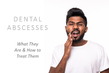 Fuquay-Varina dentist, Dr. Bryden McCormick at Fuquay Family Dentistry, explains what dental abscesses are and what action you can take to prevent them.