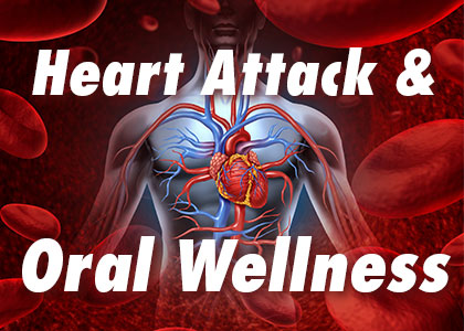 Fuquay-Varina dentist, Dr. McCormick, Dr. Meunier, & Dr. Adams at Fuquay Family Dentistry explains the connection between poor oral hygiene and heart attacks.