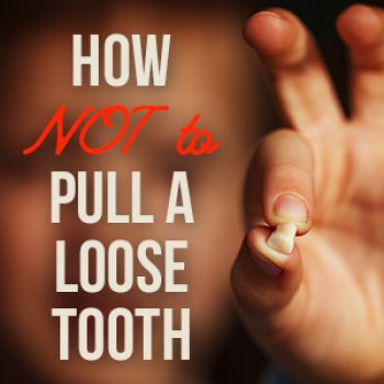 Fuquay-Varina dentists, Dr. McCormick, Dr. Meunier, Dr. Adams at Fuquay Family Dentistry, tells parents the do’s and don’ts of pulling your child’s loose baby teeth for the safest and most painless experience.