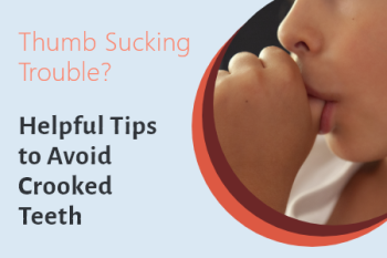 Fuquay-Varina dentist, Dr. McCormick at Fuquay Family Dentistry, explains the potential problems that can come from thumb sucking and what steps can be taken.