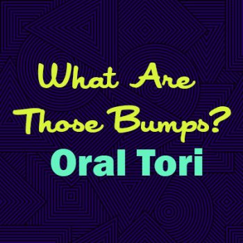 Fuquay-Varina dentist, Drs. McCormick, Meunier, & Adams at Fuquay Family Dentistry explains oral tori—what they are, why they happen, and whether they are a cause for concern.